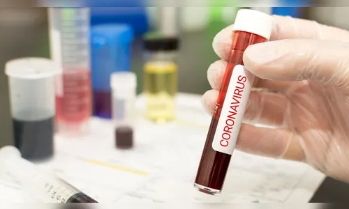 Mais 30 pessoas testam positivo para a Covid-19 em Apucarana