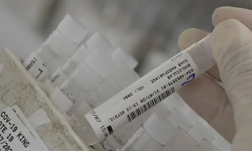 Em seis meses, Estado acumula 3.761 mortes por Covid-19