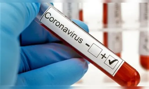 São Pedro do Ivaí volta a registrar caso positivo de Covid-19