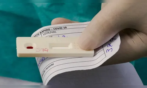 Brasil registra 4,33 milhões de casos de covid-19 e 131,6 mil mortes