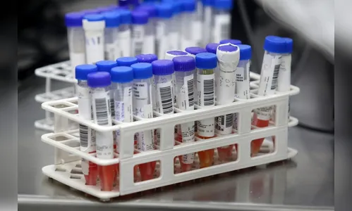 Homem é reinfectado pelo novo coronavírus em Paranavaí