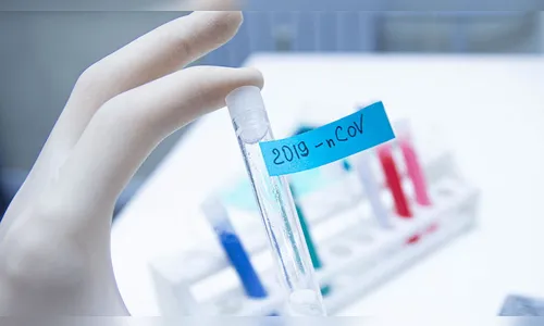 Arapongas confirma mais 2 óbitos e 25 novos casos de Covid-19