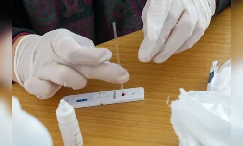 Projeto que regulamenta testes de covid-19 em farmácias é aprovado na Assembleia