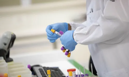 Casos da covid-19 no Brasil caem 30% e mortes, 13%