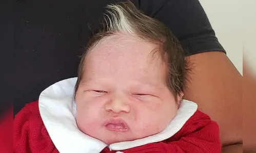 Bebê que nasceu com mecha branca no cabelo faz sucesso nas redes sociais