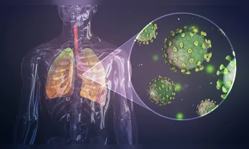 Arapongas registra 17 novos casos de Covid-19 e um curado