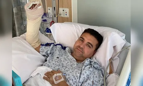 Buddy Valastro detalha acidente que causou cirurgia em sua mão