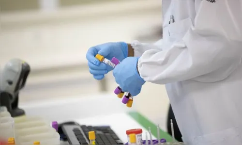 Jardim Alegre tem mais três casos positivos de Covid-19