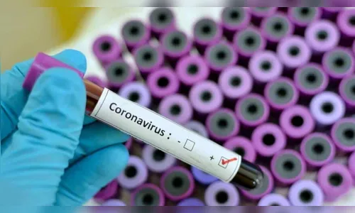 Ivaiporã tem mais 11 casos positivos do novo coronavírus