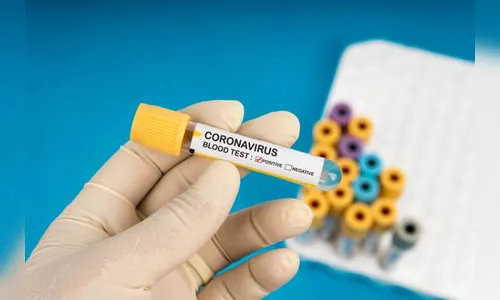 Boletim da Sesa registra 1.384 novos casos da Covid-19