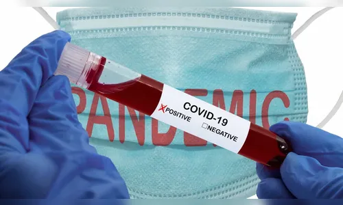 Saúde de Ivaiporã registra neste sábado (3), mais cinco novos casos de Covid-19