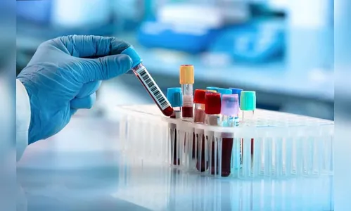 Paraná registra 1.555 novos casos da Covid-19