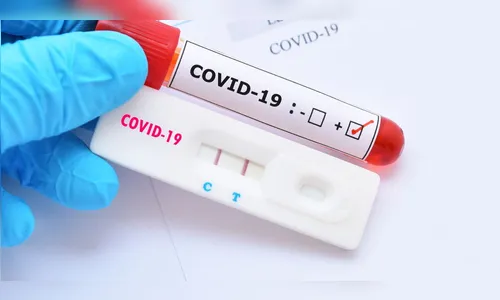 Paraná registra 467 novos casos do novo coronavírus