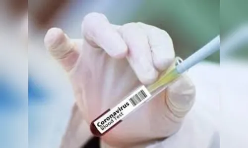 Vacina contra coronavírus da Johnson & Johnson tem testes suspensos