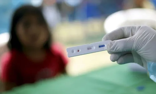 Países recorrem a exame mais rápido para conter nova onda de covid-19