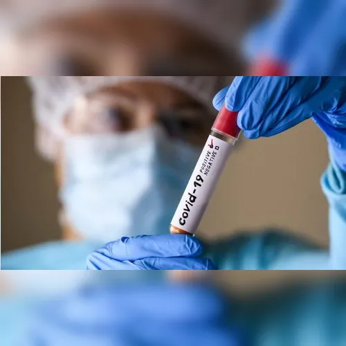 Ivaiporã tem cinco novos casos de Covid-19 e um óbito em investigação
