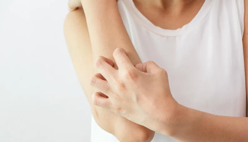 Segundo pesquisadores, pacientes com covid-19 prolongada podem ter problemas de pele
