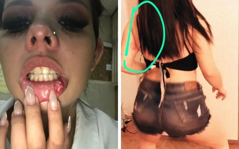 Modelo e influencer digital apucaranense denuncia companheiro por agressões