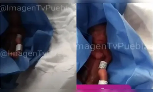 Pai descobre que filho está vivo poucos antes da funerária levar o recém-nascido; vídeo