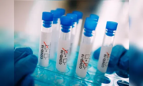 Mais uma pessoa é diagnosticadas com Covid-19 em Jardim Alegre, nesta terça (3)