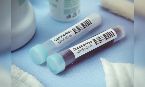 Paraná confirma 1.026 novos casos e 11 mortes decorrentes da Covid-19