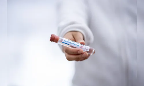 Covid-19: Maringá registra mais 1 óbito e 45 novos casos