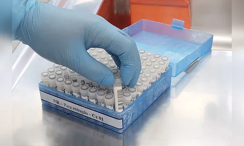 Com mais 24 diagnósticos, Apucarana passa dos 1,8 mil casos de covid