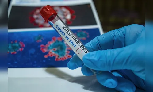 Paraná ultrapassa 240 mil casos de Covid-19