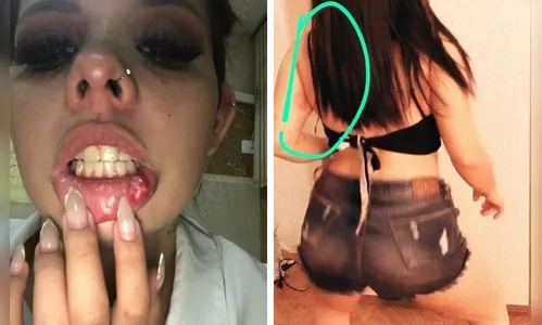 Suspeito de agredir digital influencer apucaranense nega acusações