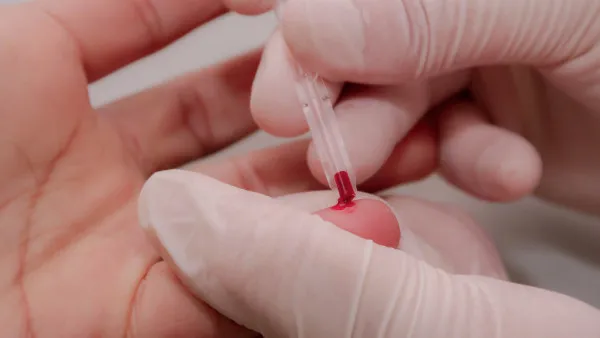 Pandemia reduz procura por testes de HIV