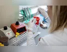 Ivaiporã confirma 25 casos de Covid-19 nesta quarta (25)