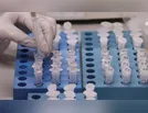 Saúde de Ivaiporã registra 12 casos de Covid-19 nesta segunda (07)