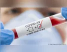 Faxinal registra mais uma morte por coronavírus e 25 novos casos