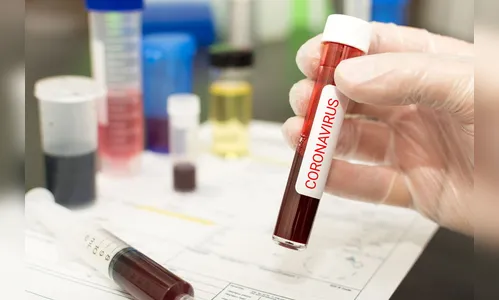 Apucarana registra 40 novos casos de Covid-19 nesta quarta-feira