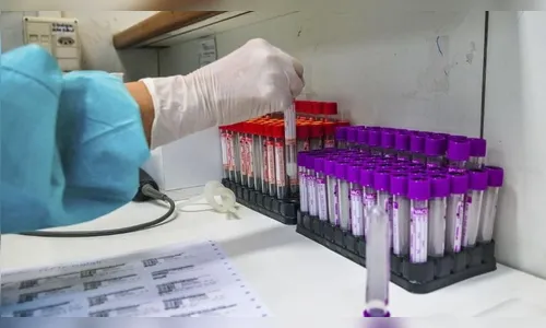 Mais 1.823 pessoas foram diagnosticadas com Covid-19 no Paraná