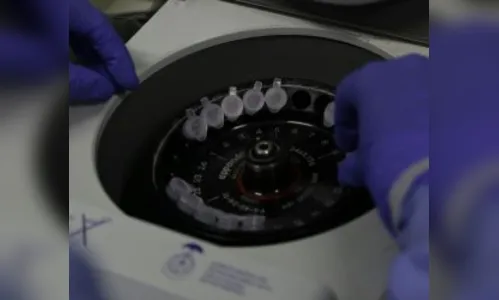 Mais duas pessoas testam positivo para Covid-19 em Jardim Alegre