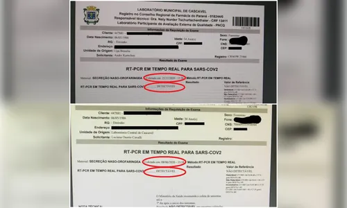 Profissional da saúde é diagnosticada com Covid-19 pela 2ª vez