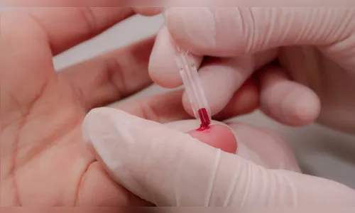 Pandemia reduz procura por testes de HIV