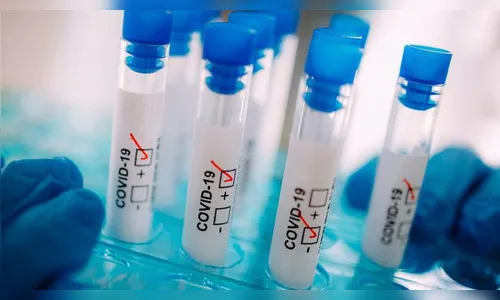 Paraná registra mais 2.628 casos confirmados por Covid-19