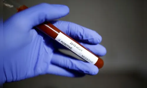 Maringá registra mais 2 óbitos e 65 novos casos de coronavírus