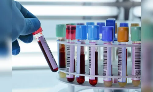 Maringá registra 421 casos e 5 óbitos por coronavírus