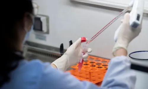 Brasil passa das 180 mil mortes desde início da pandemia