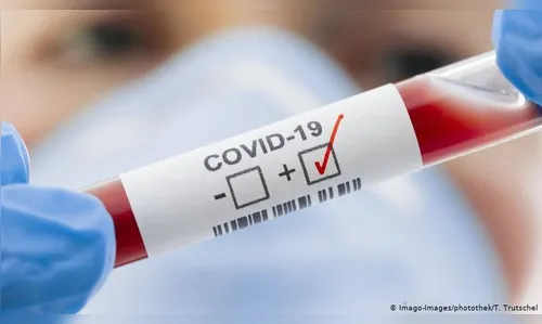 Faxinal registra mais uma morte por coronavírus e 25 novos casos