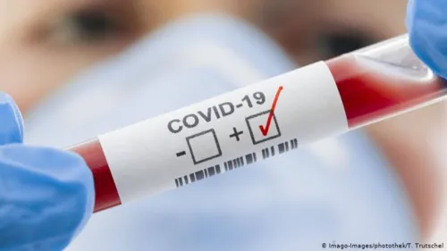 Faxinal registra mais uma morte por coronavírus e 25 novos casos