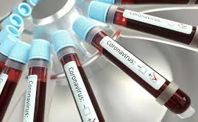 Apucarana registra 10 novos casos de coronavírus