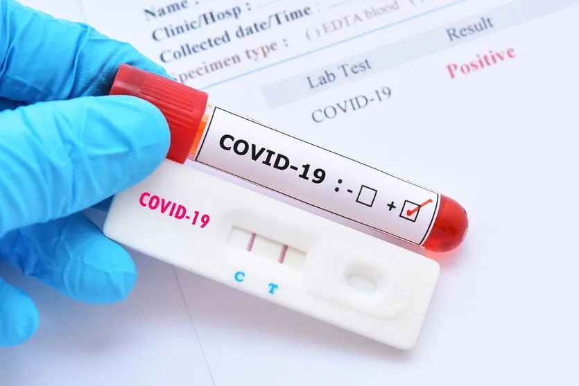 Jandaia do Sul confirma mais 8 casos de Covid-19
