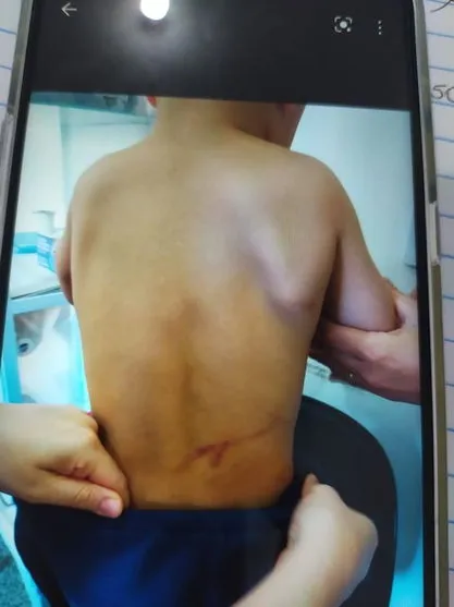 Menino de 4 anos sofre tortura e pais são presos; VÍDEO