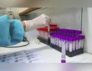 Ivaiporã registra nesta sexta-feira (01/01) mais 13 casos de coronavírus