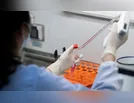 Sete casos de Covid-19 são confirmados em Ivaiporã nesta quinta (4/2)
