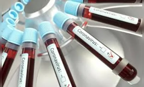 Apucarana registra 10 novos casos de coronavírus